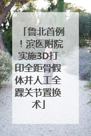 鲁北首例！滨医附院实施3D打印全距骨假体并人工全踝关节置换术